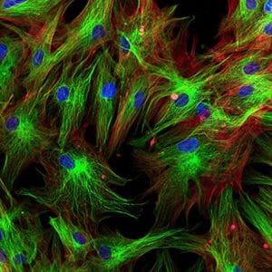 X Chromosome Breakthrough: Unlocking Cognitive Potential