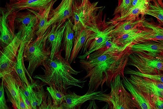 X Chromosome Breakthrough: Unlocking Cognitive Potential