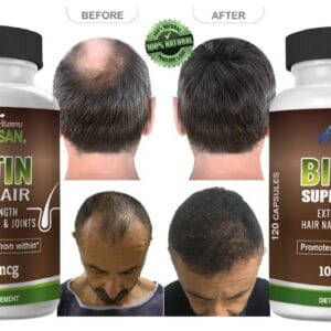 Revita Hair Growth Vitamins Hair Loss support to Growth 240 caps ...