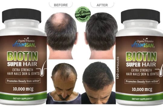 Revita Hair Growth Vitamins Hair Loss support to Growth 240 caps ...